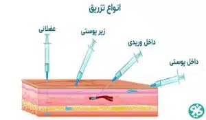 آموزش تزریق داروها و تزریقات برای بیماران